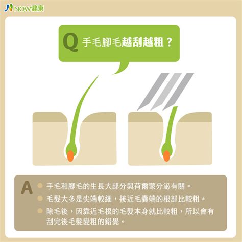 膝蓋毛|腳毛會愈刮愈粗？身體 5 處除毛，醫師建議這樣處理